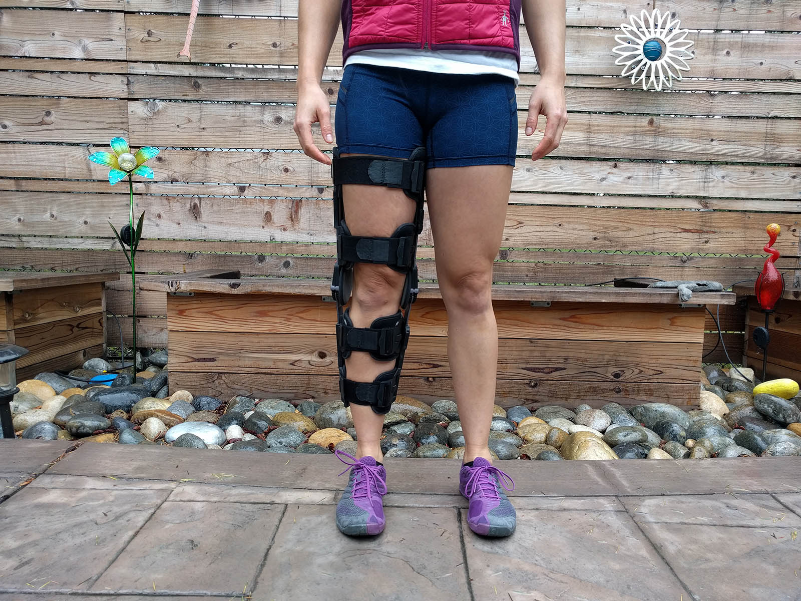 Climber's Guide to ACL Surgery Part 4 patchwork&pebbles